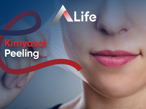 Kimyasal Peeling
